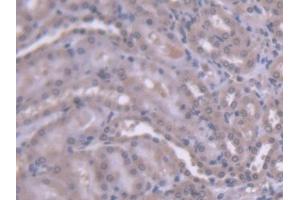DAB staining on IHC-P; Samples: Rat Kidney Tissue (HEXB antibody  (AA 100-216))
