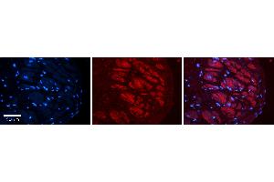 Rabbit Anti-ADAR Antibody   Formalin Fixed Paraffin Embedded Tissue: Human heart Tissue Observed Staining: Cytoplasmic Primary Antibody Concentration: 1:100 Other Working Concentrations: N/A Secondary Antibody: Donkey anti-Rabbit-Cy3 Secondary Antibody Concentration: 1:200 Magnification: 20X Exposure Time: 0. (ADAR antibody  (C-Term))