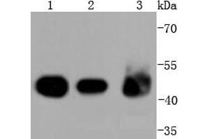 Lane 1: A431 Cell lysates, Lane 2: Mouse colon lysates, Lane 3: Mouse kidney lysates, probed with Cytokeratin 18 (1F11) Monoclonal Antibody  at 1:2000 overnight at 4˚C. (Cytokeratin 18 antibody)