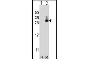 Western blot analysis of MOBKL1B (arrow) using rabbit polyclonal MOBKL1B Antibody (N-term) (ABIN656811 and ABIN2846025). (MOB1A antibody  (N-Term))