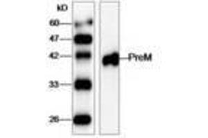 Image no. 1 for anti-West Nile Virus (WNV) (AA 1-135) antibody (ABIN791628) (West Nile Virus antibody  (AA 1-135))