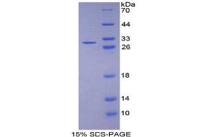 SDS-PAGE analysis of Human Fibulin 1 Protein.