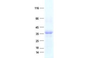 Validation with Western Blot (OVOL1 Protein (His tag))