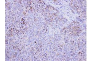 IHC-P Image Immunohistochemical analysis of paraffin-embedded DLD-1 xenograft , using HSD17B4, antibody at 1:500 dilution. (HSD17B4 antibody)