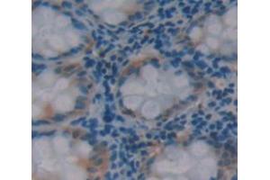 Used in DAB staining on fromalin fixed paraffin- embedded Kidney tissue (HAUS7 antibody  (AA 4-319))