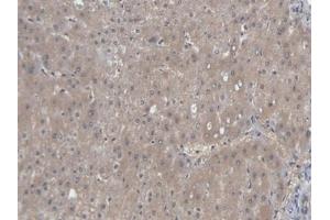 Detection of AST in Human Liver Tissue using Polyclonal Antibody to Aspartate Aminotransferase (AST) (GOT1 antibody  (AA 1-413))