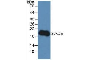 Detection of IL10 in Rat Lymphocytes Cells using Polyclonal Antibody to Interleukin 10 (IL10) (IL-10 antibody  (AA 19-178))