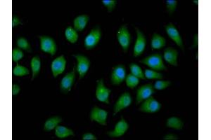 Immunofluorescence staining of A549 cells with ABIN7151037 at 1:166, counter-stained with DAPI. (HECW2 antibody  (AA 495-641))