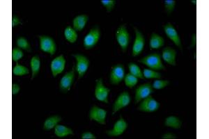 Immunofluorescence staining of A549 cells with ABIN7151037 at 1:166, counter-stained with DAPI.