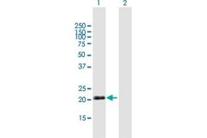Western Blot analysis of IGJ expression in transfected 293T cell line by IGJ MaxPab polyclonal antibody.