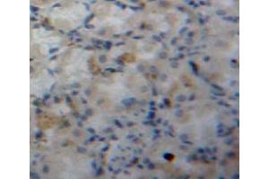 #VALUE! (FABP5 antibody  (AA 2-135))