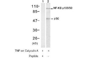 Image no. 2 for anti-Nuclear Factor of kappa Light Polypeptide Gene Enhancer in B-Cells 1 (NFKB1) (Ser337) antibody (ABIN197123) (NFKB1 antibody  (Ser337))