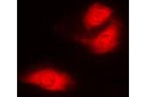 Immunofluorescent analysis of G3BP1 staining in A549 cells. (G3BP1 antibody  (Center))