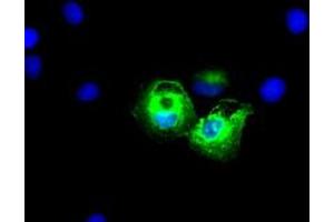 Anti-KRT8 mouse monoclonal antibody (ABIN2452349) immunofluorescent staining of COS7 cells transiently transfected by pCMV6-ENTRY KRT8 (RC209570). (KRT8 antibody  (AA 91-381))