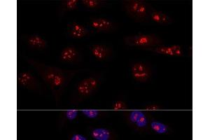 Confocal immunofluorescence analysis of U2OS cells using NOP58 Polyclonal Antibody at dilution of 1:100. (NOP58 antibody)