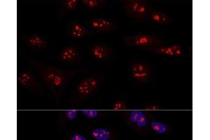 Confocal immunofluorescence analysis of U2OS cells using NOP58 Polyclonal Antibody at dilution of 1:100.