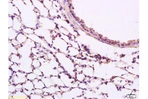 Formalin-fixed and paraffin embedded rat lung labeled with Anti phospho-Src(Tyr418) Polyclonal Antibody, Unconjugated (ABIN746153) at 1:200 followed by conjugation to the secondary antibody and DAB staining (Src antibody  (pTyr418))