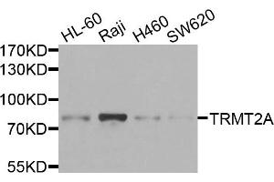 Western blot analysis of extracts of various cells, using TRMT2A antibody. (TRMT2A antibody)
