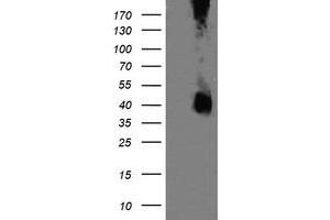 Image no. 4 for anti-Mitogen-Activated Protein Kinase Kinase 3 (MAP2K3) antibody (ABIN1499399) (MAP2K3 antibody)