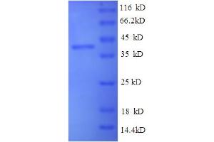 SDS-PAGE (SDS) image for Selenoprotein P (SEPP1) (AA 20-381) protein (His tag) (ABIN4976044)