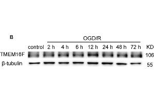 TMEM16F protein level increases after ischemic insult. (Anoctamin 6 antibody  (AA 744-824))
