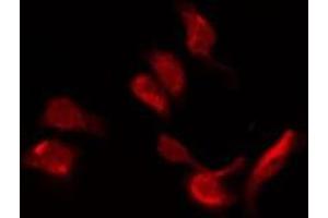 anti-G Protein-Coupled Receptor 151 (GPR151) (C-Term) antibody