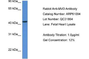 Western Blotting (WB) image for anti-Mevalonate (Diphospho) Decarboxylase (MVD) (N-Term) antibody (ABIN2774304) (MVD antibody  (N-Term))