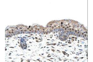 Image no. 1 for anti-Interferon Regulatory Factor 4 (IRF4) (N-Term) antibody (ABIN6737818) (IRF4 antibody  (N-Term))
