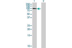 Western Blot analysis of MBD1 expression in transfected 293T cell line by MBD1 MaxPab polyclonal antibody.