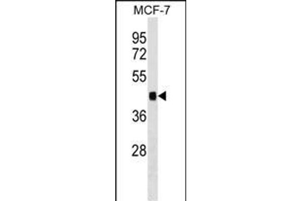 IER5 Antikörper  (AA 122-149)