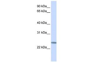 C12ORF49 antibody used at 1 ug/ml to detect target protein. (C12orf49 antibody  (C-Term))