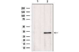 Western blot analysis of extracts from Mouse Myeloma cell, using PYCR1 antibody. (PYCR1 antibody  (Internal Region))
