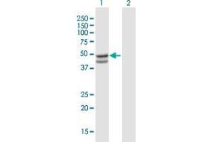 Western Blot analysis of SERPINB7 expression in transfected 293T cell line by SERPINB7 MaxPab polyclonal antibody. (SERPINB7 antibody  (AA 1-380))