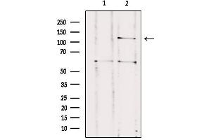 Western blot analysis of extracts from HUVEC, using CNTNAP3 Antibody.