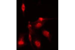 ABIN6276872 staining HeLa cells by IF/ICC.