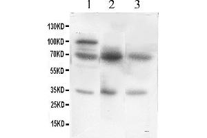 Western Blotting (WB) image for anti-Glutamate Decarboxylase 1 (Brain, 67kDa) (GAD1) (AA 14-122) antibody (ABIN3042415) (GAD antibody  (AA 14-122))