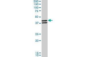 NEU2 monoclonal antibody (M03), clone 3B9. (NEU2 antibody  (AA 180-268))