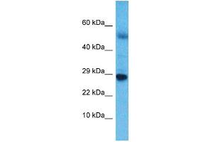 Host:  Rabbit  Target Name:  NKX6-3  Sample Type:  Esophagus Tumor lysates  Antibody Dilution:  1.