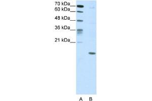 WB Suggested Anti-DUX5 Antibody Titration:  5. (DUX5 antibody  (C-Term))