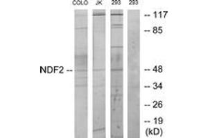 Western blot analysis of extracts from 293/COLO/Jurkat cells, using NDF2 Antibody. (NEUROD2 antibody  (AA 61-110))