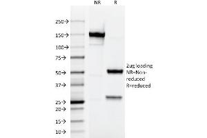 SDS-PAGE Analysis Purified Testosterone Mouse Monoclonal Antibody (4E1G2). (Testosterone antibody)