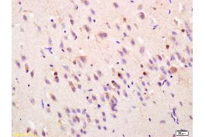 Formalin-fixed and paraffin embedded rat brain labeled with Rabbit Anti FGF1/AFGF Polyclonal Antibody, Unconjugated (ABIN726590) at 1:200 followed by conjugation to the secondary antibody and DAB staining (FGF1 antibody  (AA 16-80))