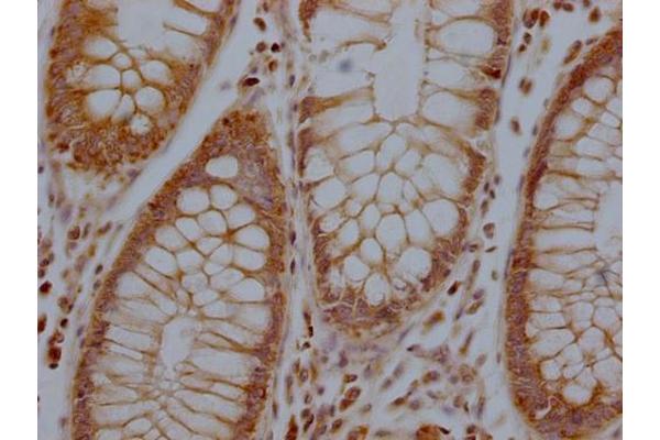 RHBDF2 antibody  (AA 1-200)
