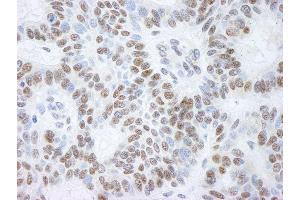 Immunohistochemistry (IHC) image for anti-Lysine (K)-Specific Demethylase 1A (KDM1A) (AA 50-100) antibody (ABIN7448433) (LSD1 antibody  (AA 50-100))