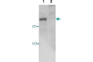 Western blot was performed on whole cell lysates from mouse fibroblasts (Lane 1, NIH/3T3) and embryonic stem cells (Lane 2, E14Tg2a) with Setd1a polyclonal antibody , diluted 1 : 500 in BSA/PBS-Tween. (SETD1A antibody)