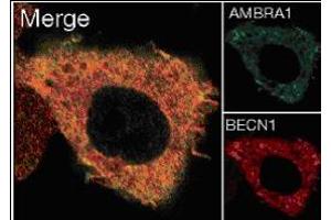 Image no. 3 for anti-Autophagy/beclin-1 Regulator 1 (AMBRA1) (N-Term) antibody (ABIN347117)