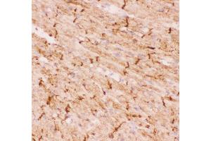 Immunohistochemistry (IHC) image for anti-Desmin (DES) (AA 1-304) antibody (ABIN3043265)