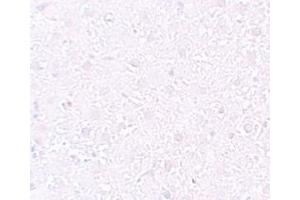 Immunohistochemistry (IHC) image for anti-Mesenchyme Homeobox 1 (MEOX1) (Middle Region) antibody (ABIN1031005) (MEOX1 antibody  (Middle Region))