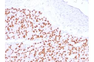 Formalin-fixed, paraffin-embedded human Thyroid stained with PAX8 Recombinant Rabbit Monoclonal Antibody (PAX8/2774R). (Recombinant PAX8 antibody  (AA 60-261))