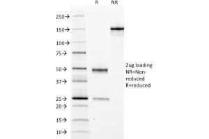 SDS-PAGE Analysis of Purified, BSA-Free Ferritin Light Chain Antibody (clone FTL/1388). (FTL antibody  (AA 38-165))
